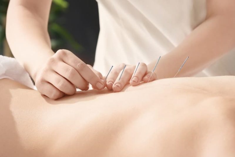 Tratamiento de acupuntura para aliviar el dolor de espalda en Sevilla
